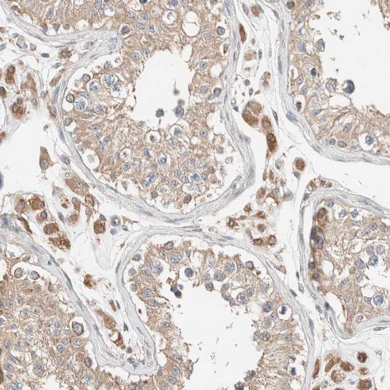 Staining of human testis shows moderate cytoplasmic positivity in Leydig cells.