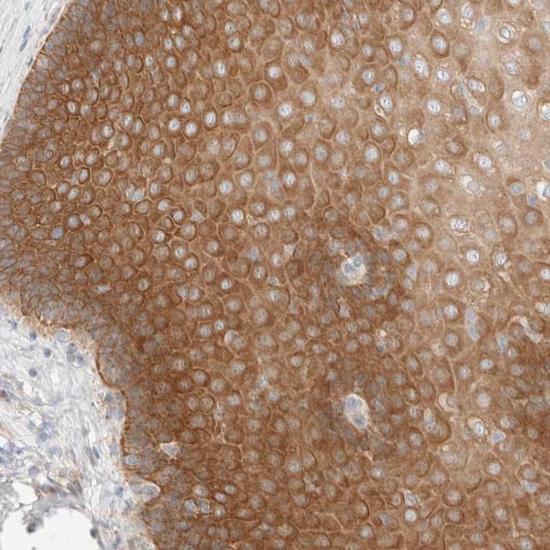 Staining of human esophagus shows moderate cytoplasmic positivity in squamous epithelial cells.