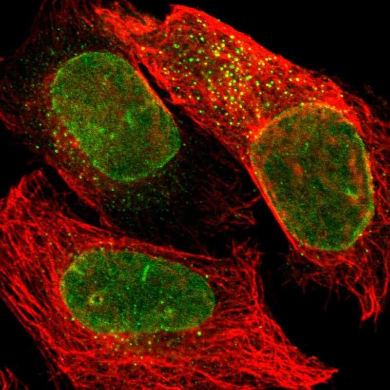 Staining of human cell line U-2 OS shows localization to nuclear membrane & vesicles.