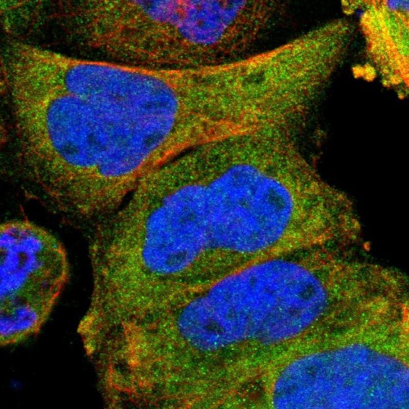 Staining of human cell line A-431 shows localization to cytosol.