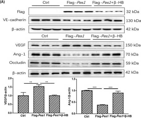  beta ‐HB treatment impaired the increment of paracellular permeability by in vitro supplementation of Pes1. (A, B) The protein levels of PES1, VEGF, VE‐cadherin, Ang‐1 and Occludin in MVECs were detected by immunoblotting after Flag‐Pes1 plus  beta ‐HB treatment. (C, D) Shown are immunofluorescence images of Flag‐Pes1 plus  beta ‐HB‐treated MVECs for Occludin and VE‐cadherin expression and localizations, scale bar represents 20 μm. The nuclei were stained with DAPI. (E) Exhibited is the paracellular permeability in the cultured MVECs in different groups. Data were represented as mean +/- SEM, each experiment was performed independently three times. **p < 0.01, ***p < 0.001 compared with control (anova, Student–Newman–Keuls q‐test). Image collected and cropped by CiteAb from the following open publication (//pubmed.ncbi.nlm.nih.gov/37060584), licensed under a CC-BY license. Not internally tested by Novus Biologicals.