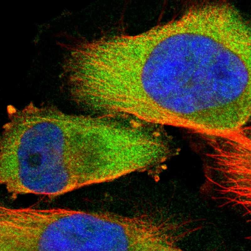 Staining of human cell line U-251 MG shows localization to cytosol.