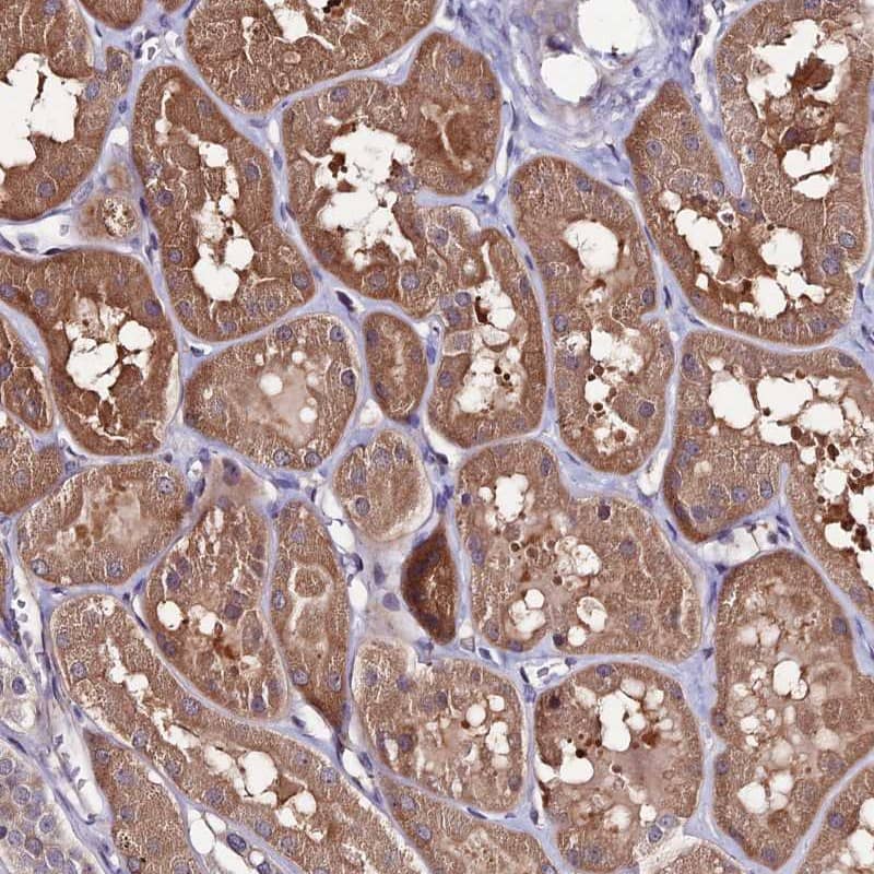 Staining of human kidney shows moderate cytoplasmic positivity in tubular cells.