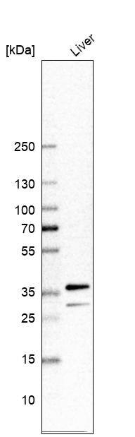 Analysis in human liver tissue.