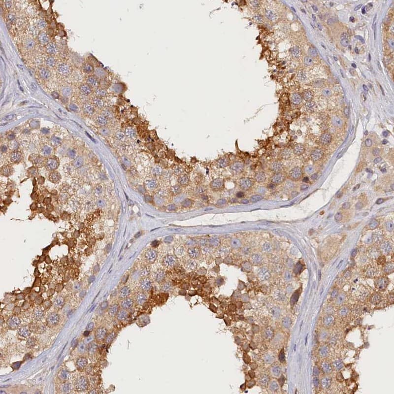Staining of human testis shows high expression.