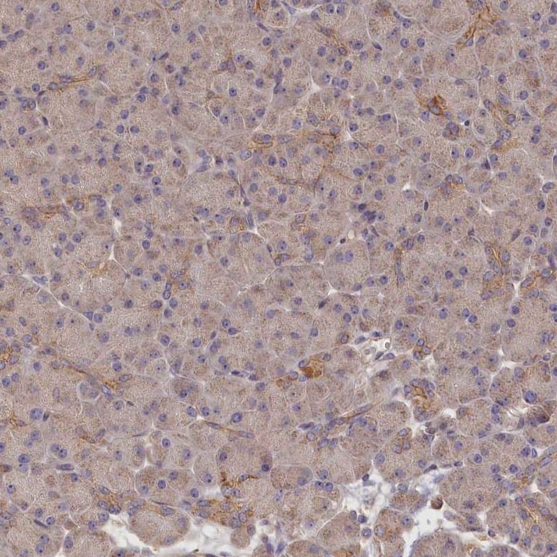 Staining of human pancreas shows low expression as expected.