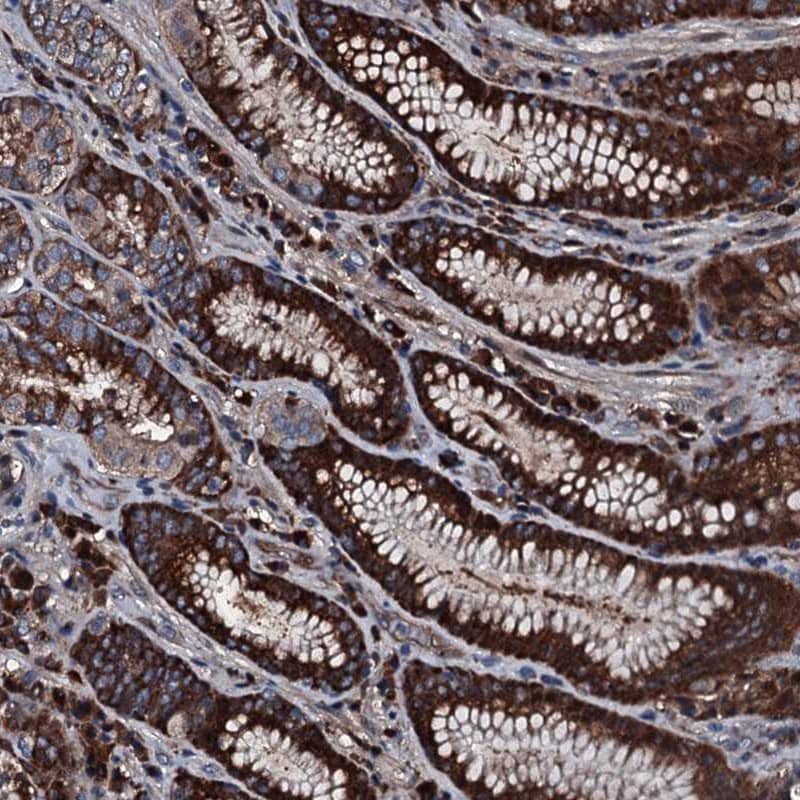 Immunohistochemistry-Paraffin Alanyl tRNA synthetase Antibody - BSA Free