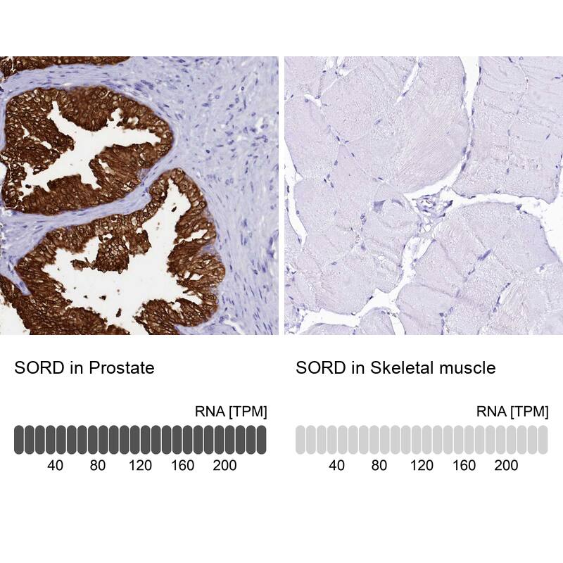 <b>Orthogonal Strategies Validation. </b>Analysis in human prostate and skeletal muscle tissues. Corresponding RNA-seq data are presented for the same tissues.