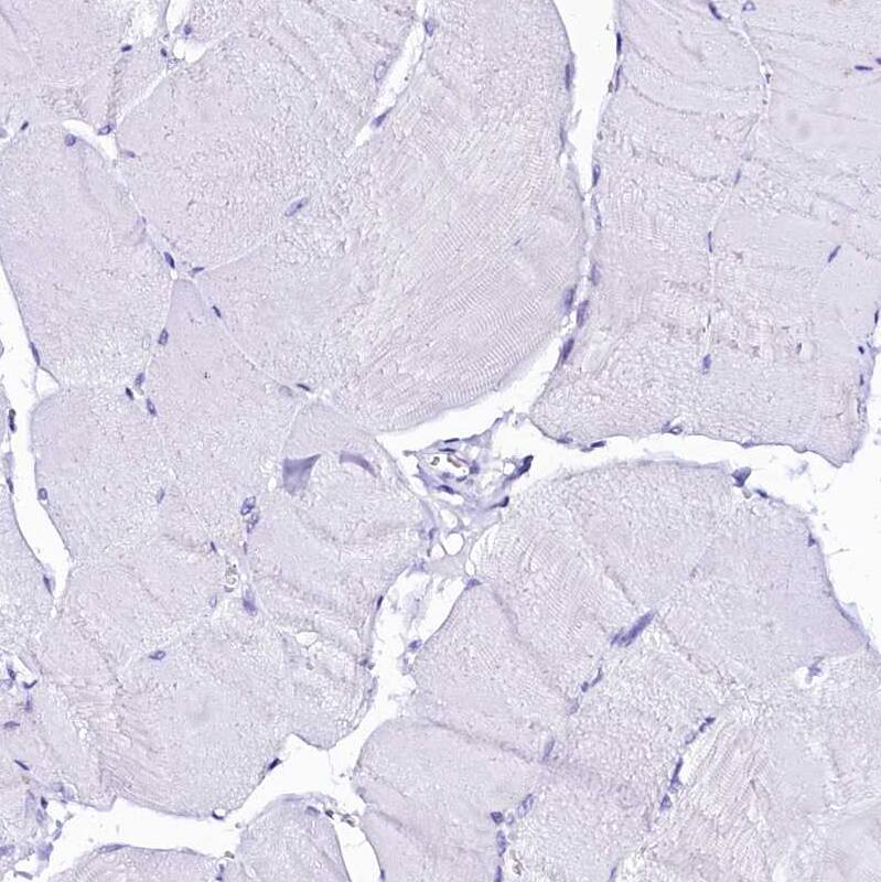 Staining of human skeletal muscle shows no positivity in myocytes as expected.