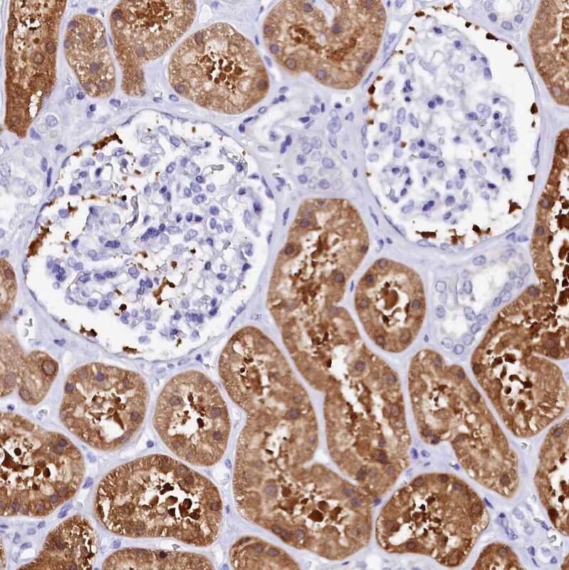 Staining of human kidney shows strong cytoplasmic positivity in cells in tubules.