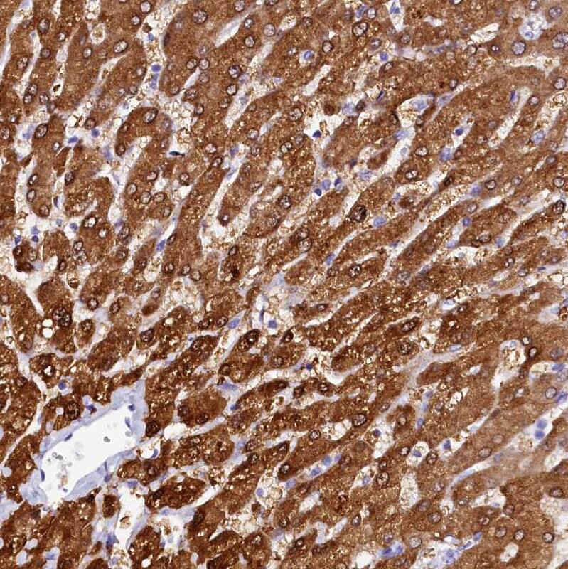 Staining of human liver shows strong cytoplasmic positivity in hepatocytes.