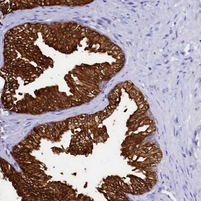 Staining of human prostate shows strong cytoplasmic positivity in glandular cells.