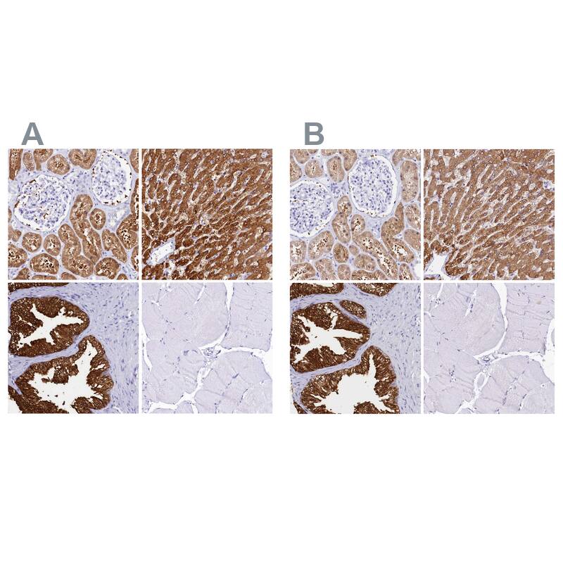 <b>Orthogonal Strategies Validation. </b>Staining of human kidney, liver, prostate and skeletal muscle HPA040260 (A) shows similar protein distribution across tissues to independent antibody HPA040621 (B).