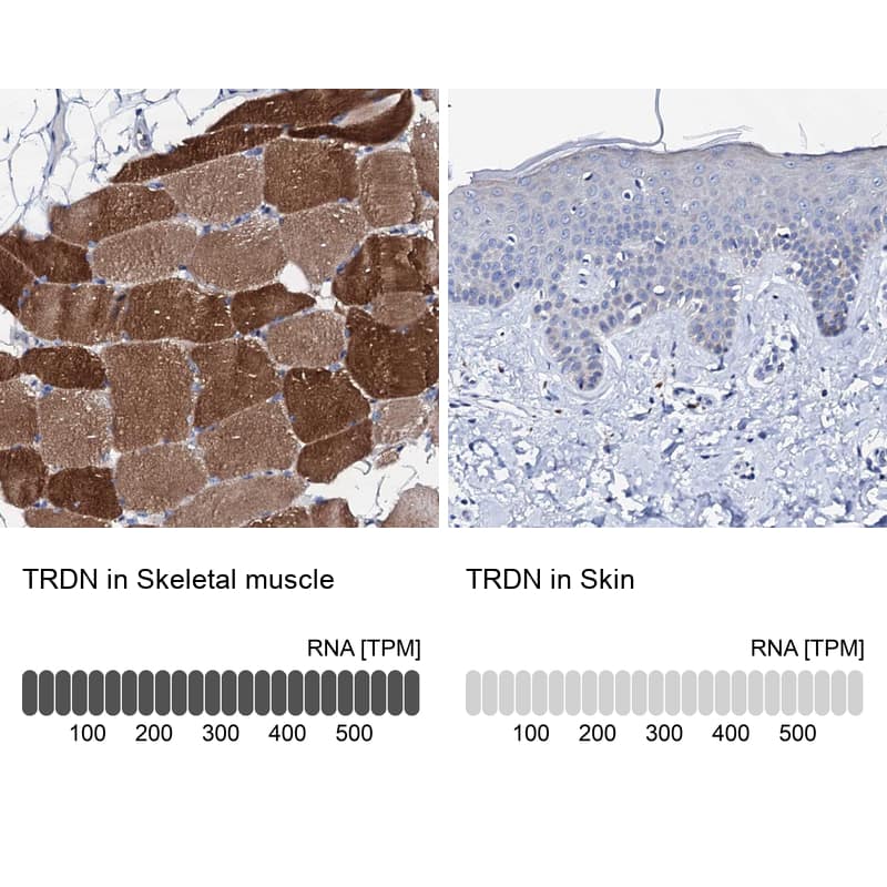 Immunohistochemistry-Paraffin Triadin Antibody - BSA Free