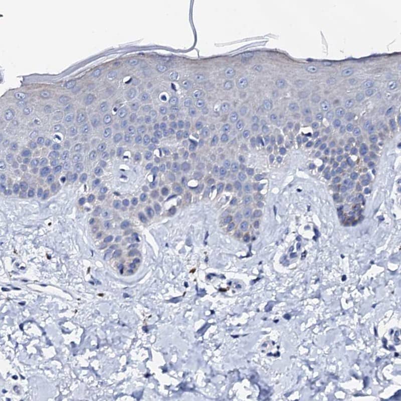 Immunohistochemistry-Paraffin Triadin Antibody - BSA Free