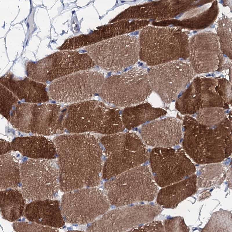 Staining of human skeletal muscle shows high expression.