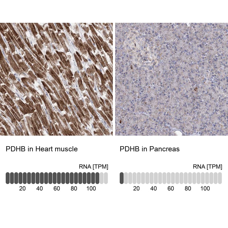 <b>Independent Antibodies Validation and Orthogonal Strategies Validation.</b>Analysis in human heart muscle and pancreas tissues. Corresponding RNA-seq data are presented for the same tissues.