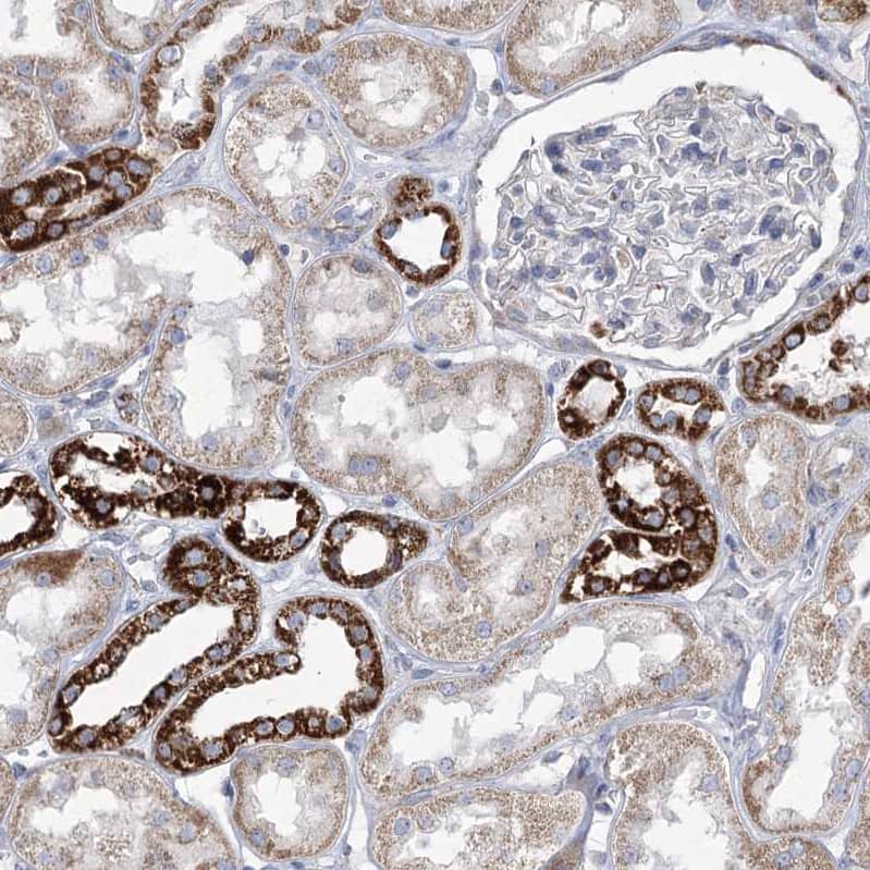 Staining of human kidney shows strong granular cytoplasmic positivity in cells in distal tubules.