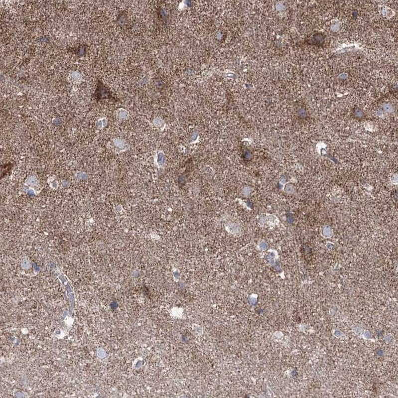 Staining of human cerebral cortex shows moderate positivity in neuropil.