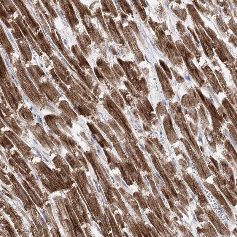 Staining of human heart muscle shows strong cytoplasmic positivity in cardiomyocytes.