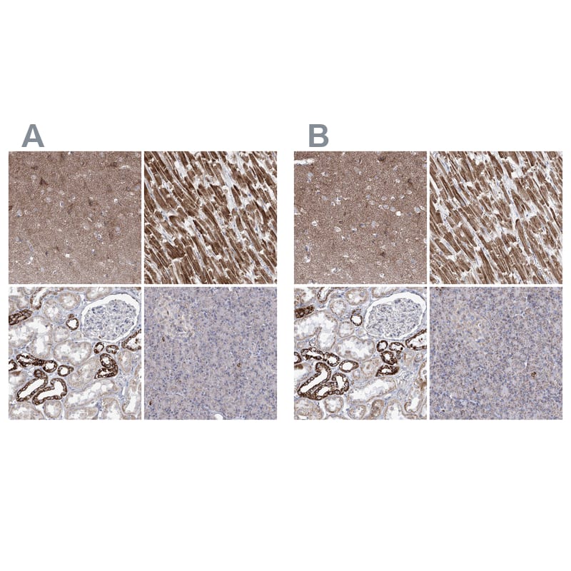 <b>Orthogonal Strategies Validation. </b>Staining of human cerebral cortex, heart muscle, kidney and pancreas HPA036744 (A) shows similar protein distribution across tissues to independent antibody HPA036745 (B).