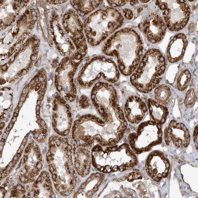 Staining of human Kidney shows strong granular cytoplasmic positivity in cells in tubules.