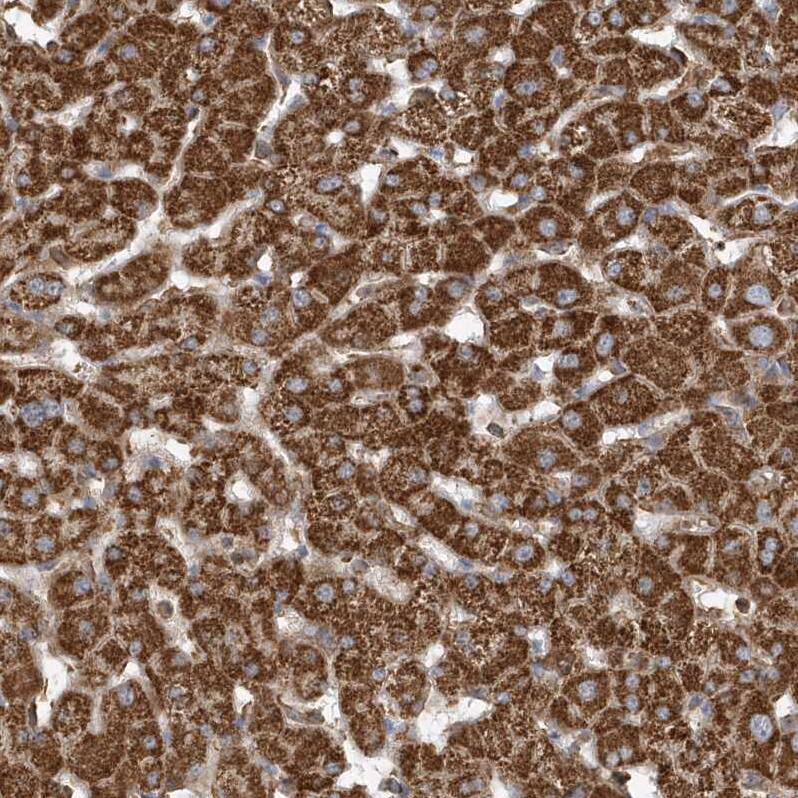Staining of human Liver shows strong granular cytoplasmic positivity in hepatocytes.