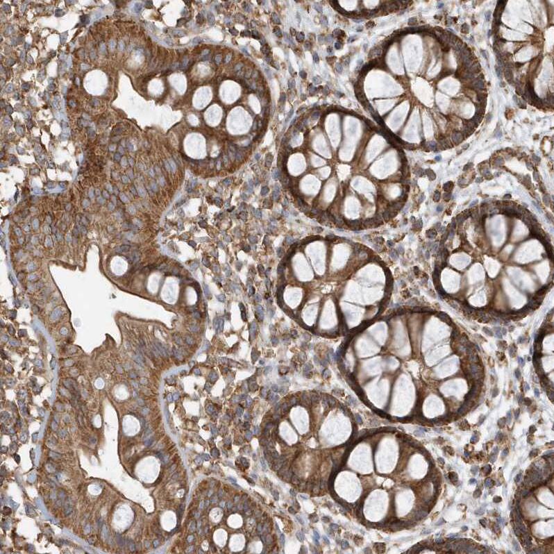 Staining of human Rectum shows strong granular cytoplasmic positivity in glandular cells.
