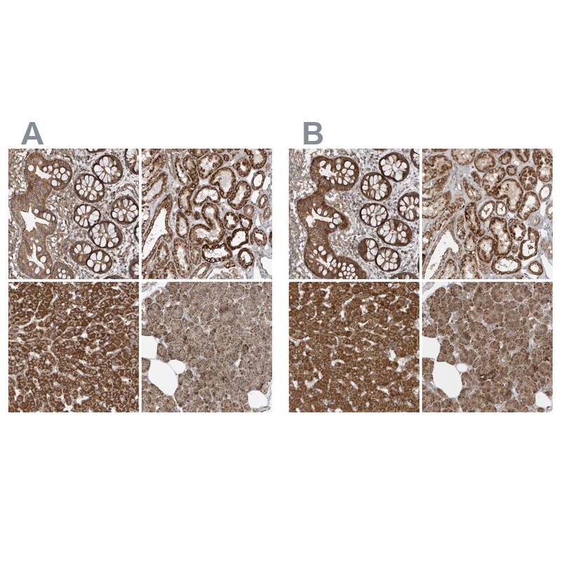 <b>Orthogonal Strategies Validation. </b>Staining of human gastrointestinal, kidney, liver and pancreas HPA035971 (A) shows similar protein distribution across tissues to independent antibody HPA035972 (B).