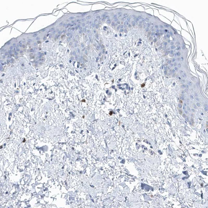 Staining of human skin shows low expression as expected.