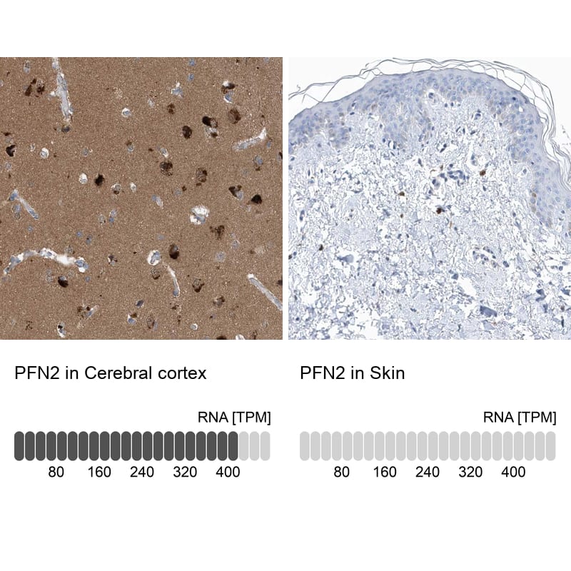 Analysis in human cerebral cortex and skin tissues.