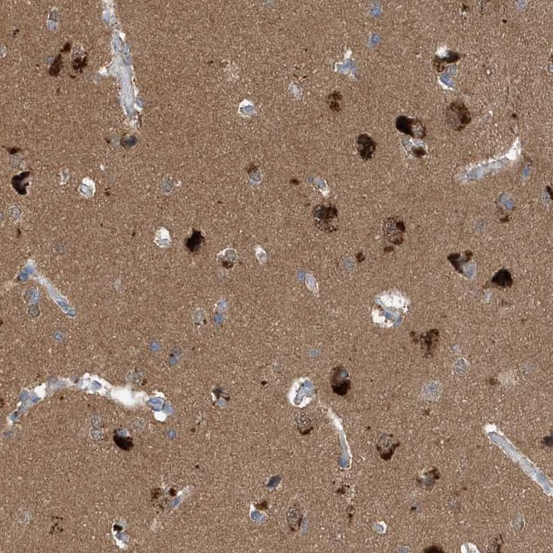 Staining of human cerebral cortex shows high expression.