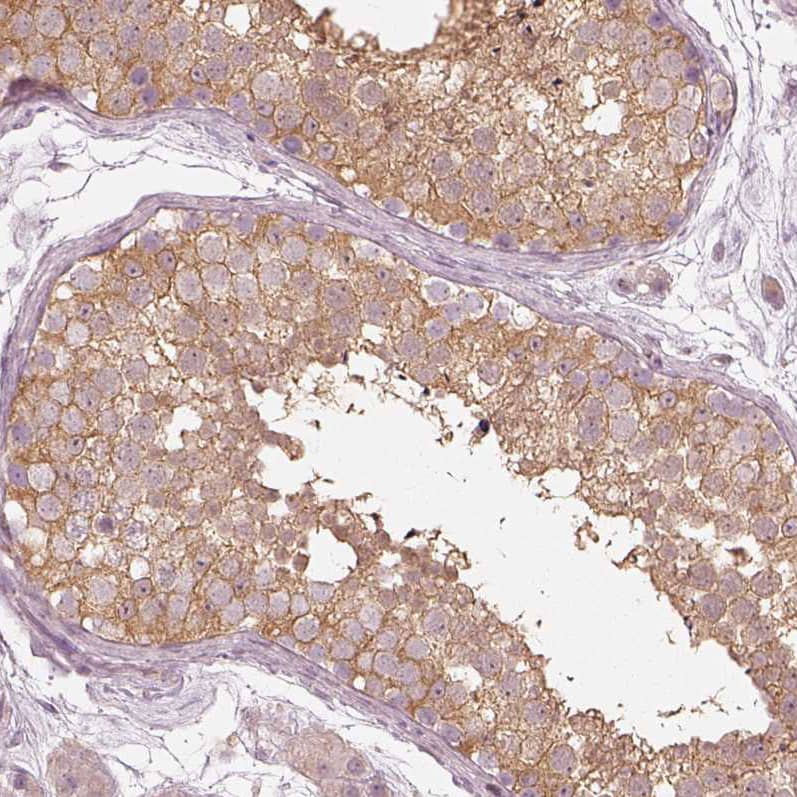 Immunohistochemistry-Paraffin Kinesin 5C Antibody - BSA Free