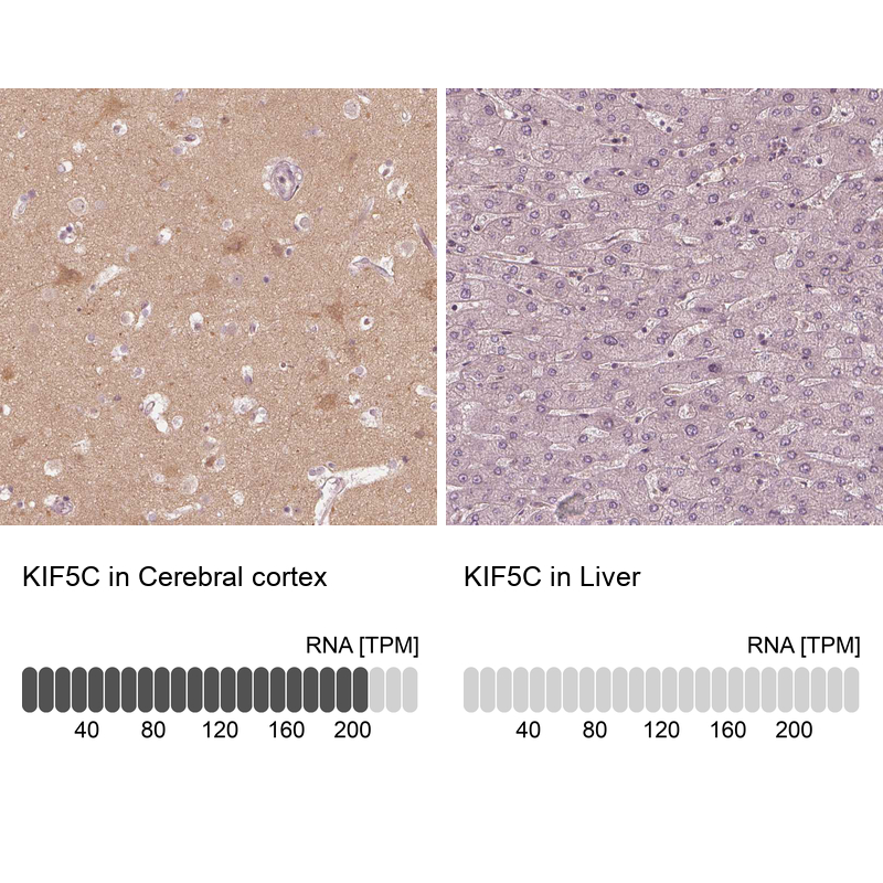 Immunohistochemistry-Paraffin Kinesin 5C Antibody - BSA Free