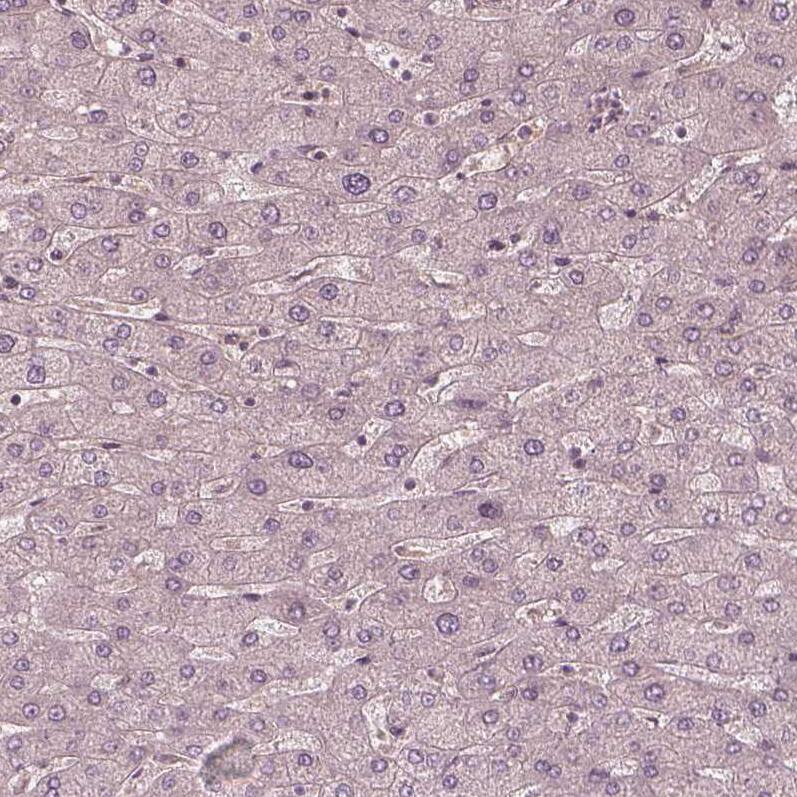 Staining of human liver shows no positivity in hepatocytes as expected.