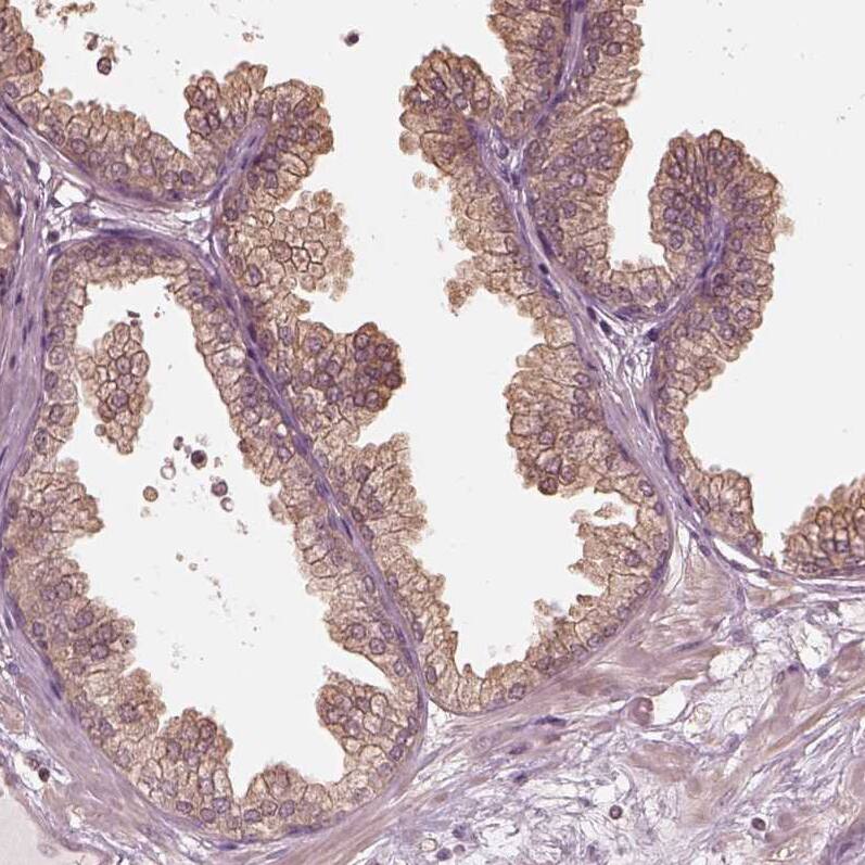 Staining of human prostate shows weak cytoplasmic positivity in glandular cells.