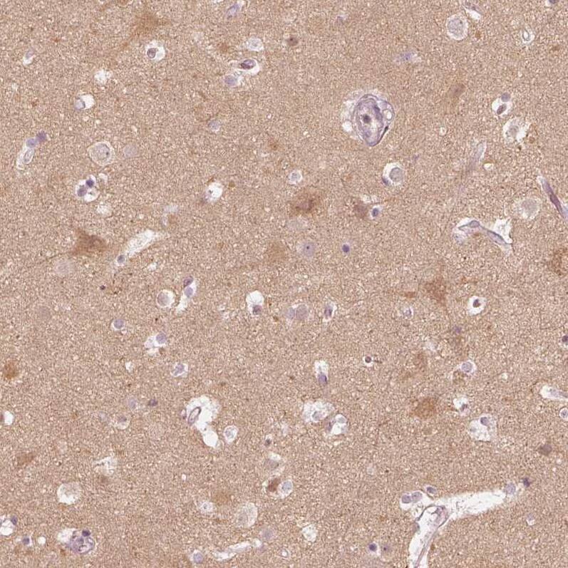 Staining of human cerebral cortex shows weak cytoplasmic positivity in neurons.