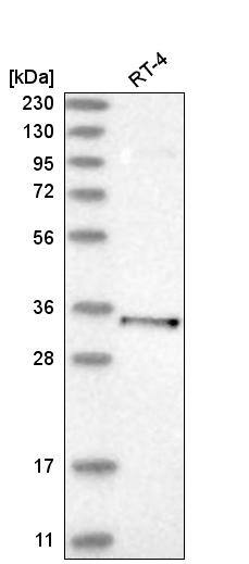 Analysis in human cell line RT-4.