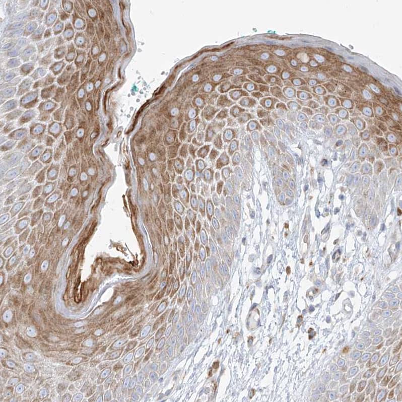 Immunohistochemistry-Paraffin Metaxin-2 Antibody - BSA Free