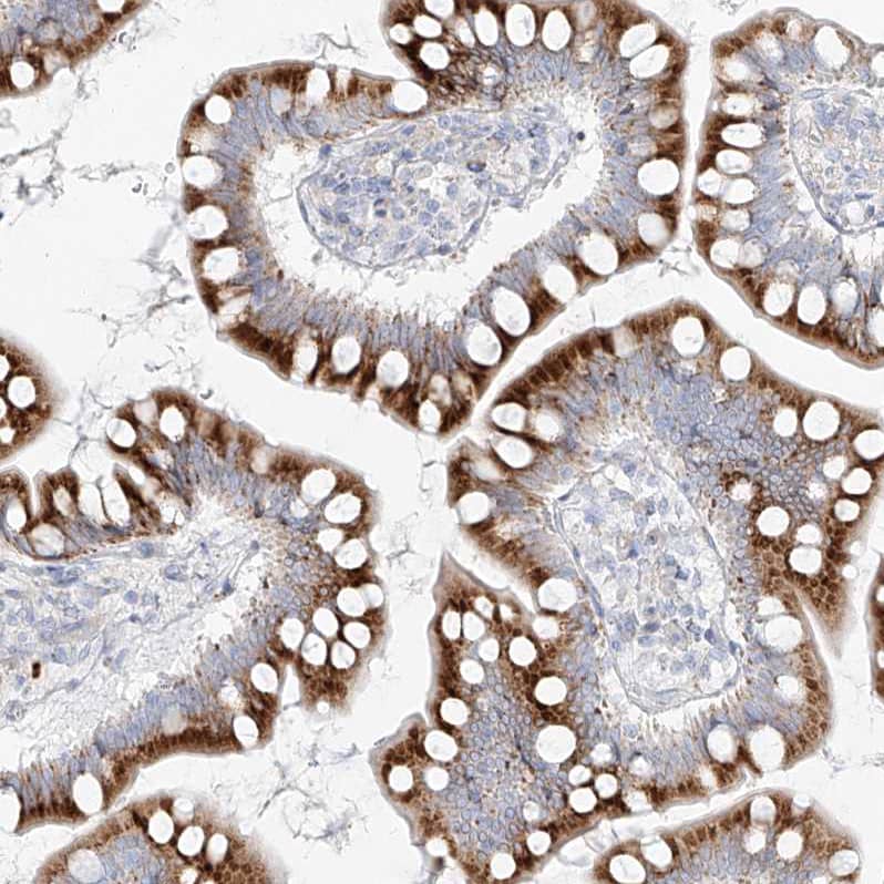 Staining of human small intestine shows strong granular cytoplasmic positivity in glandular cells.