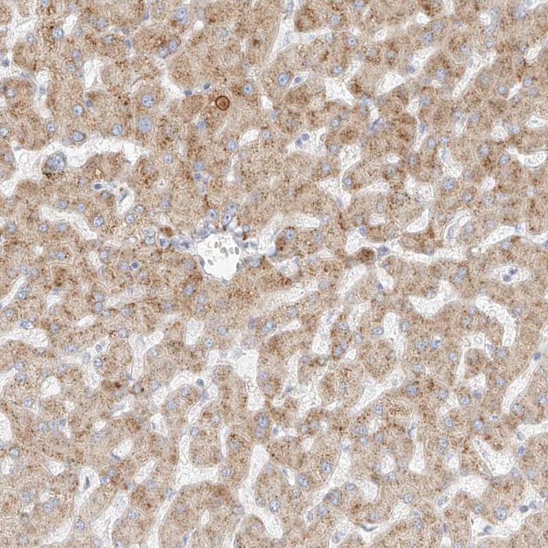 Staining of human liver shows moderate granular cytoplasmic positivity in hepatocytes.