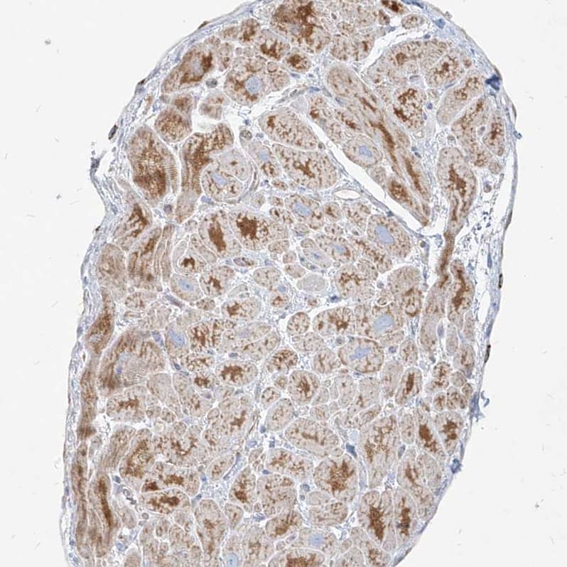 Staining of human heart muscle shows moderate granular cytoplasmic positivity in cardiomyocytes.