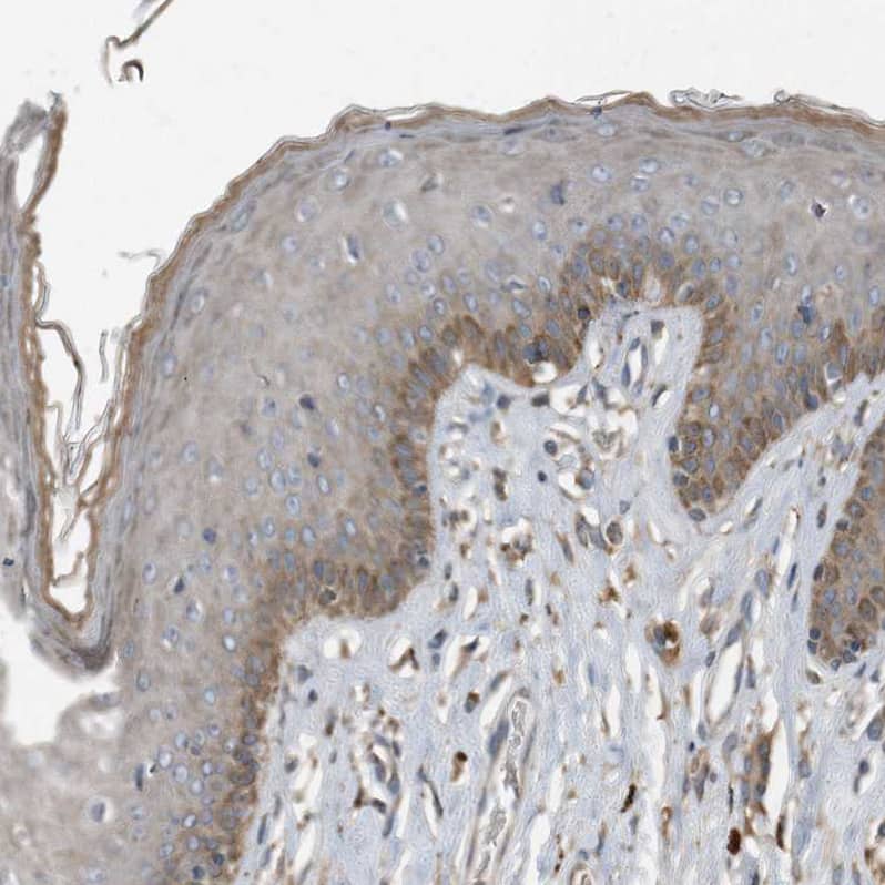 Staining of human Skin shows moderate cytoplasmic positivity in squamous epithelial cells.