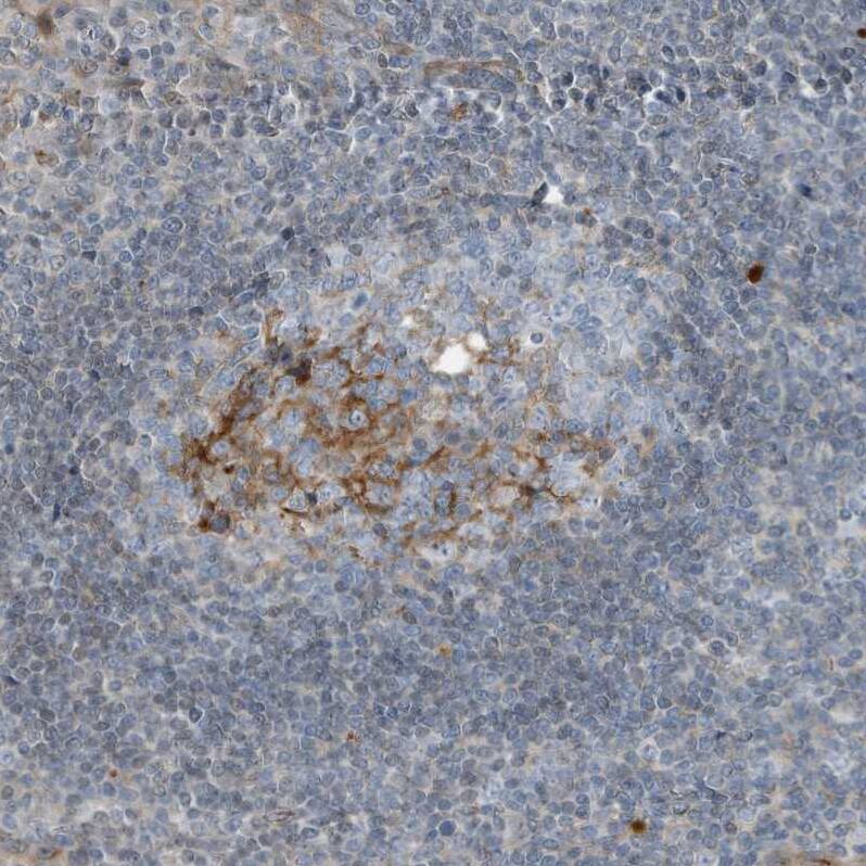 Staining of human Tonsil shows moderate cytoplasmic positivity in germinal center cells.