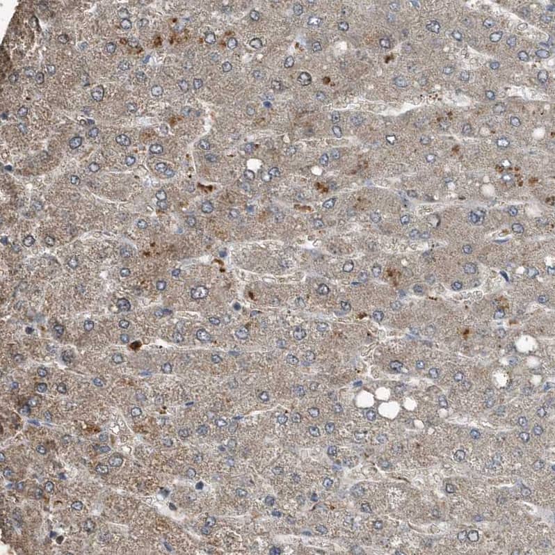 Staining of human Liver shows moderate cytoplasmic positivity in hepatocytes.