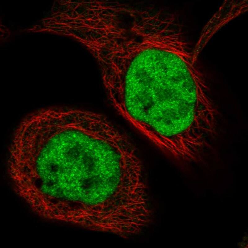 Staining of human cell line A-431 shows localization to nucleoplasm.