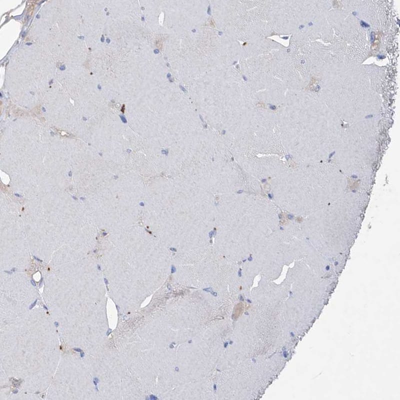Immunohistochemistry-Paraffin Asparagine synthetase Antibody - BSA Free