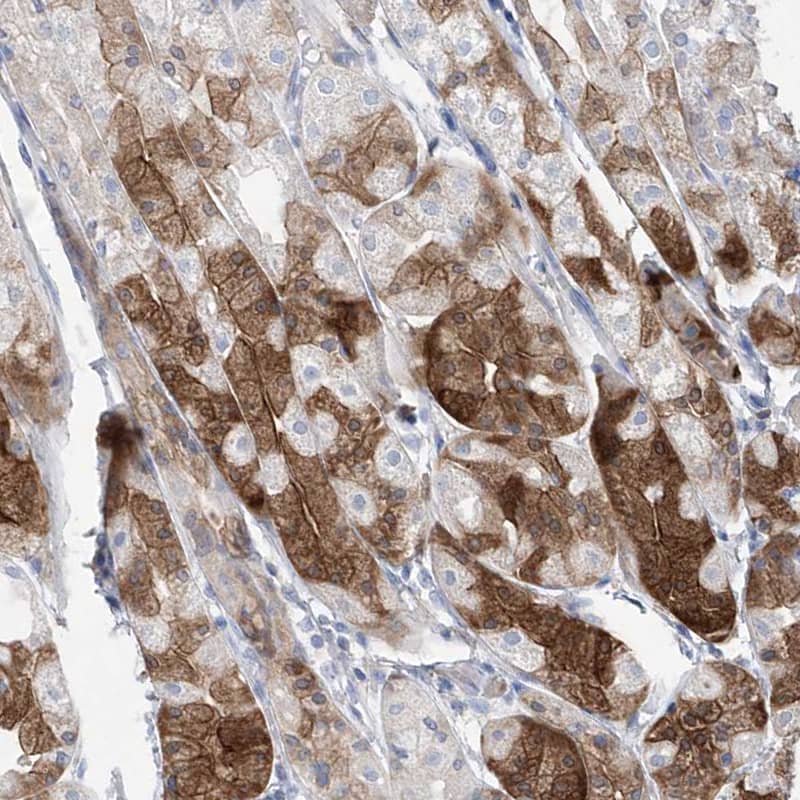 Immunohistochemistry-Paraffin Asparagine synthetase Antibody - BSA Free