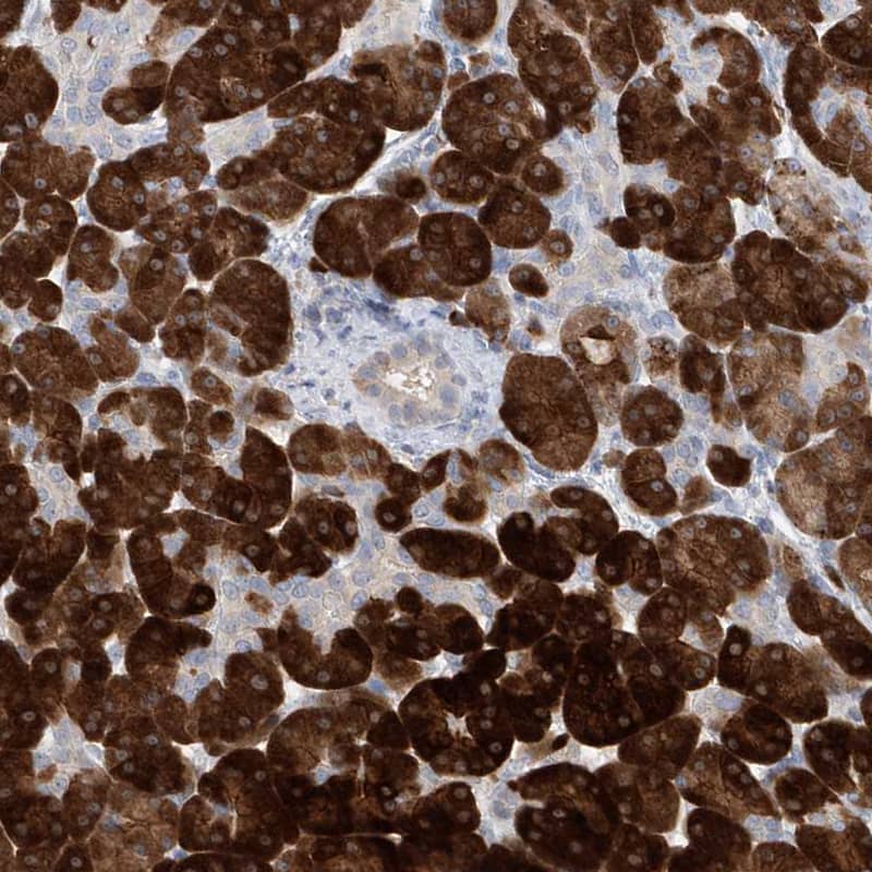 Immunohistochemistry-Paraffin Asparagine synthetase Antibody - BSA Free