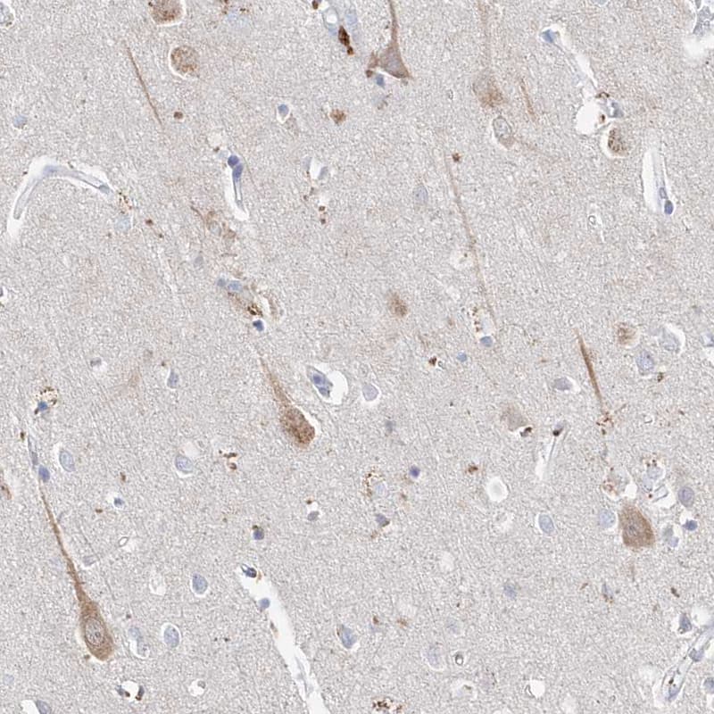 Immunohistochemistry-Paraffin Asparagine synthetase Antibody - BSA Free